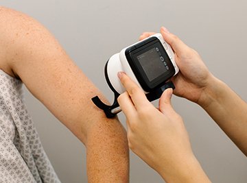 MoleMap skin check scan